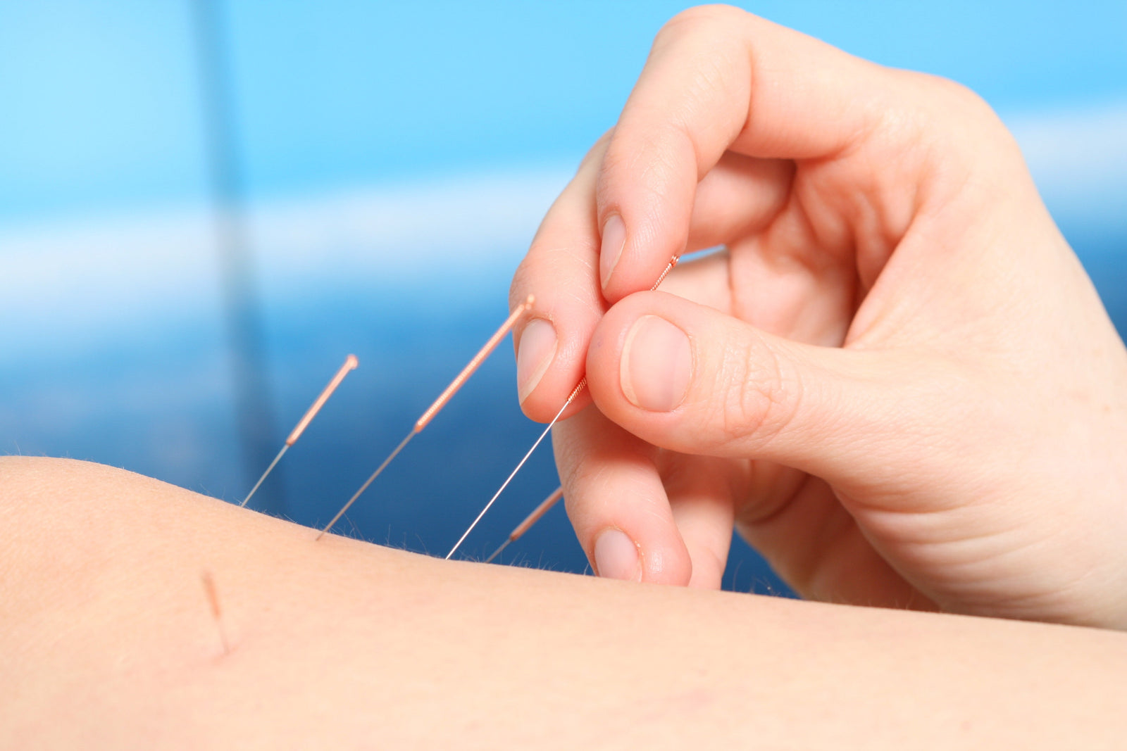 The 5 Forbidden Acupuncture Points: What Every Practitioner Should Know