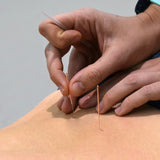Strong Acupuncture Needles.